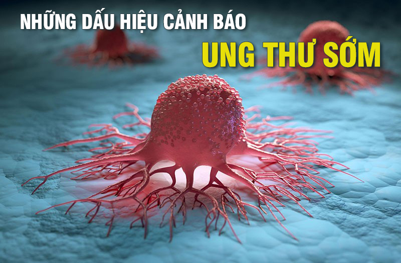 Dấu hiệu cảnh báo ung thư sớm như khối u bất thường, mệt mỏi kéo dài và sụt cân không rõ nguyên nhân